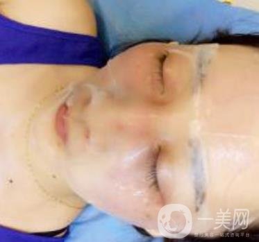 青醫(yī)附院整形美容科價格表及祛斑案例公布，速覽