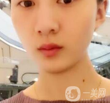 青醫(yī)附院整形美容科價格表及祛斑案例公布，速覽