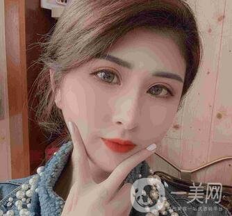 山西省整形外科醫(yī)院割雙眼皮怎么樣?案例價(jià)格表來(lái)襲