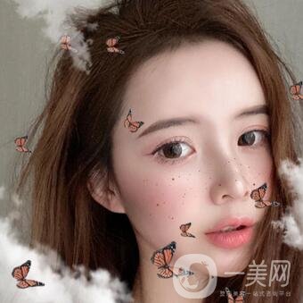 北京大學(xué)深圳醫(yī)院整形外科價格表，附雙眼皮案例