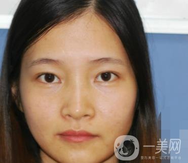 北京朝陽醫(yī)院整形中心紋眉*果怎么樣？價格價目表詳情一覽