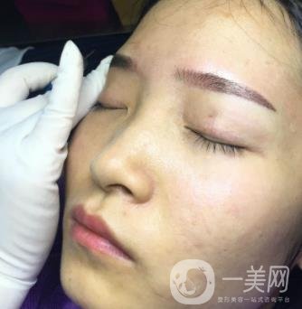 北京朝陽醫(yī)院整形中心紋眉*果怎么樣？價格價目表詳情一覽