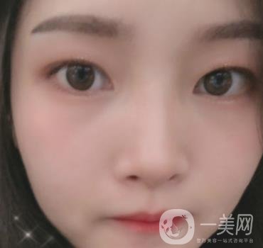 北京朝陽醫(yī)院整形中心紋眉*果怎么樣？價格價目表詳情一覽