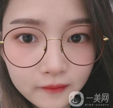 北京朝陽醫(yī)院整形中心紋眉*果怎么樣？價格價目表詳情一覽