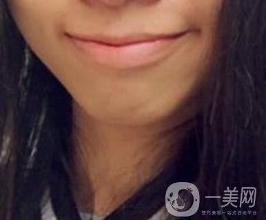 復(fù)旦大學(xué)附屬兒科醫(yī)院口腔科做牙齒矯正多少錢(qián)？?jī)r(jià)格表明細(xì)一覽