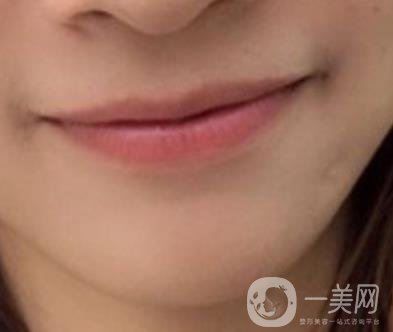 復(fù)旦大學(xué)附屬兒科醫(yī)院口腔科做牙齒矯正多少錢(qián)？?jī)r(jià)格表明細(xì)一覽