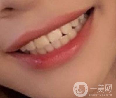 復(fù)旦大學(xué)附屬兒科醫(yī)院口腔科做牙齒矯正多少錢(qián)？?jī)r(jià)格表明細(xì)一覽