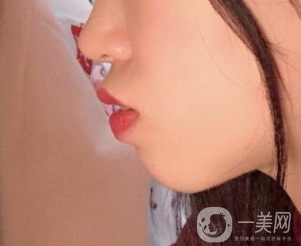 復(fù)旦大學(xué)附屬兒科醫(yī)院口腔科做牙齒矯正多少錢(qián)？?jī)r(jià)格表明細(xì)一覽