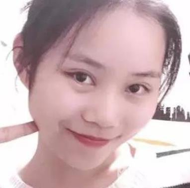 淮安第一人民醫(yī)院割雙眼皮怎樣?真人案例及整形價格表分享