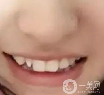 良鄉(xiāng)優(yōu)貝口腔醫(yī)院整牙