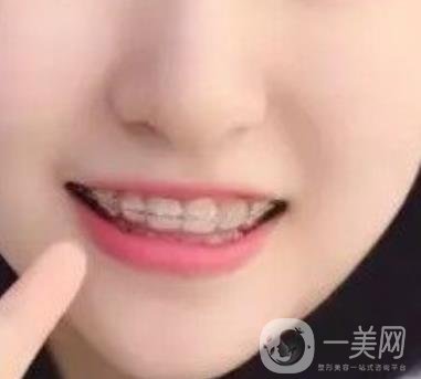 良鄉(xiāng)優(yōu)貝口腔醫(yī)院整牙