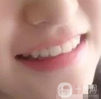 良鄉(xiāng)優(yōu)貝口腔醫(yī)院整牙