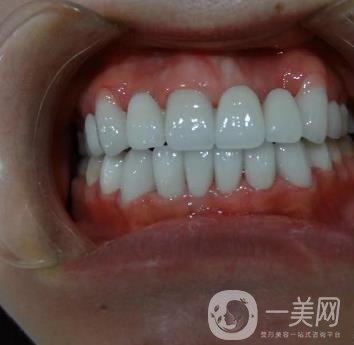 杭州格萊美醫(yī)院整牙