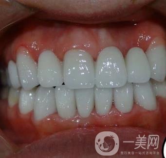 杭州格萊美醫(yī)院整牙