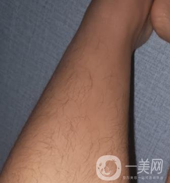 哈醫(yī)大四院整形美容科價格表鉅惠來襲，附冰點(diǎn)脫毛案例