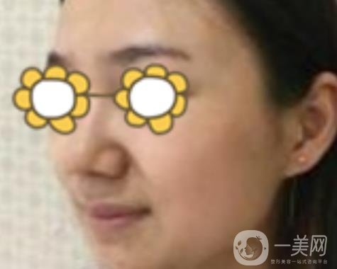 阜陽市人民醫(yī)院整形美容科價格表2020版，附*案例