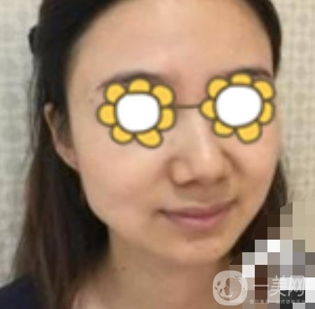 阜陽市人民醫(yī)院整形美容科價格表2020版，附*案例