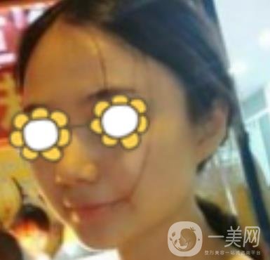 阜陽市人民醫(yī)院整形美容科價格表2020版，附*案例