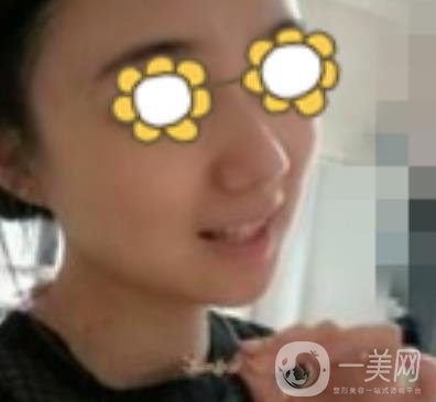 阜陽市人民醫(yī)院整形美容科價格表2020版，附*案例