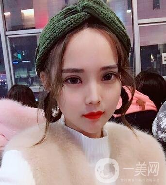 湖南第一醫(yī)院整形科價(jià)格表，附雙眼皮案例