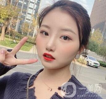 青島青醫(yī)附院整形價格表，還有雙眼皮實例