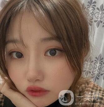 青島青醫(yī)附院整形價格表，還有雙眼皮實例