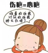 成都疤痕修復醫(yī)院介紹？應該怎么選？