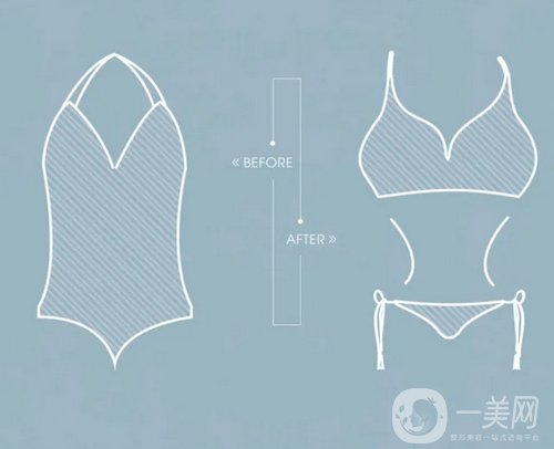 假體豐胸,假體豐胸價(jià)格,天津假體豐胸價(jià)格