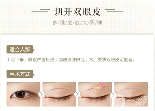 天津璦珊整形醫(yī)院雙眼皮整形日記_價(jià)格表介紹一覽