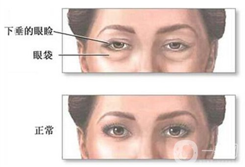 天津公安醫(yī)院整形價(jià)格表2020年，內(nèi)附做眼袋*圖