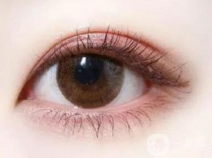 不太適合割雙眼皮的人群有哪些？