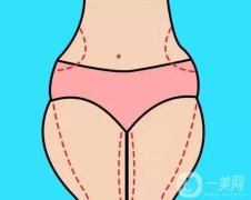 抽脂好還是溶脂好？合適人群有哪些？