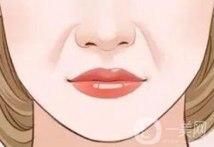 形成法令紋的原因是什么？