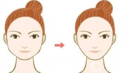 下頜角做截骨術(shù)要戴頭套的原因是什么？