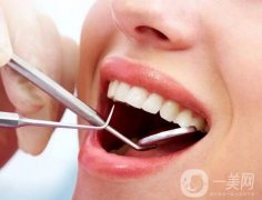 洗牙能美白牙齒嗎？洗牙對牙齒有害嗎？