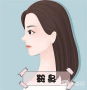 什么人群適合墊鼻梁？墊鼻梁的相關(guān)知識有哪些