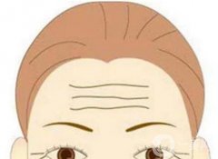 吃糖導(dǎo)致皺紋的原因是什么？怎么去掉