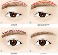 什么年齡的人適合切眉？切眉嗎？