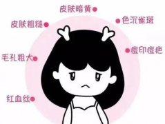 彩光嫩膚的果？彩光嫩膚有什么誤區(qū)？