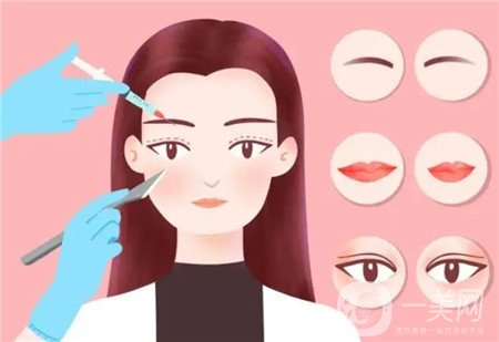 長沙美之峰解燦雙眼皮怎么樣?2020整形價格表及案例一覽