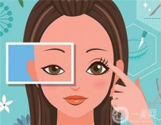 全切雙眼皮恢復(fù)自然要多長(zhǎng)時(shí)間呢？