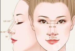 鼻唇溝怎么填充？鼻唇溝是如何形成的？