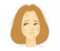 痘印可以用去除嗎？做完后需要加強(qiáng)防曬嗎？