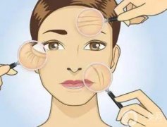 熱瑪吉可以用于哪些部位嗎?熱瑪吉是怎么做出來的?