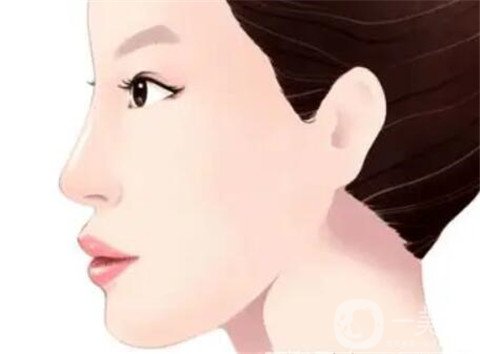 湖南省人民醫(yī)院整形美容科隆鼻*果如何？看價(jià)格表及案例實(shí)述