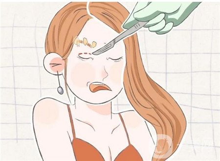 西安醫(yī)學(xué)院第二附屬醫(yī)院醫(yī)療美容科價(jià)格表和切開(kāi)雙眼皮案例公布