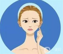 激光祛斑后有哪些飲食禁忌？