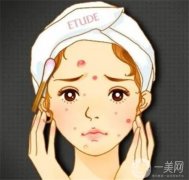 什么是？激光去斑的缺點