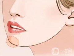 墊下巴多久才能完全恢復？怎么保養(yǎng)