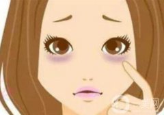 激光去除黑眼圈的特點和適應癥